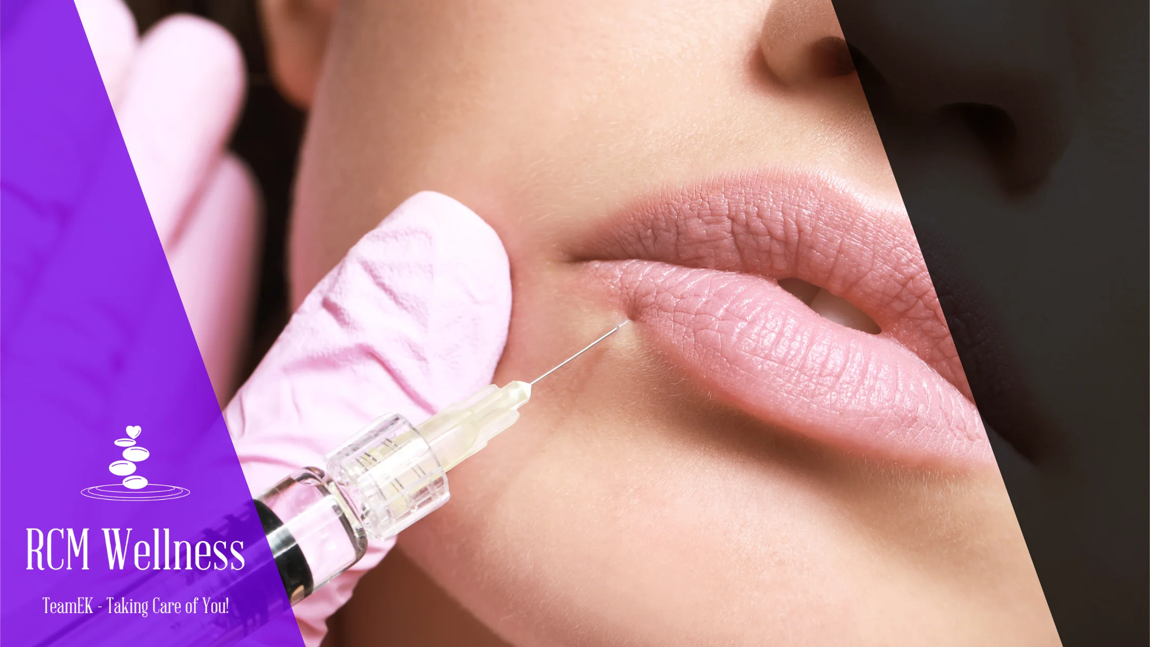 Fillers & LIPO Consultation At RCM Wellness