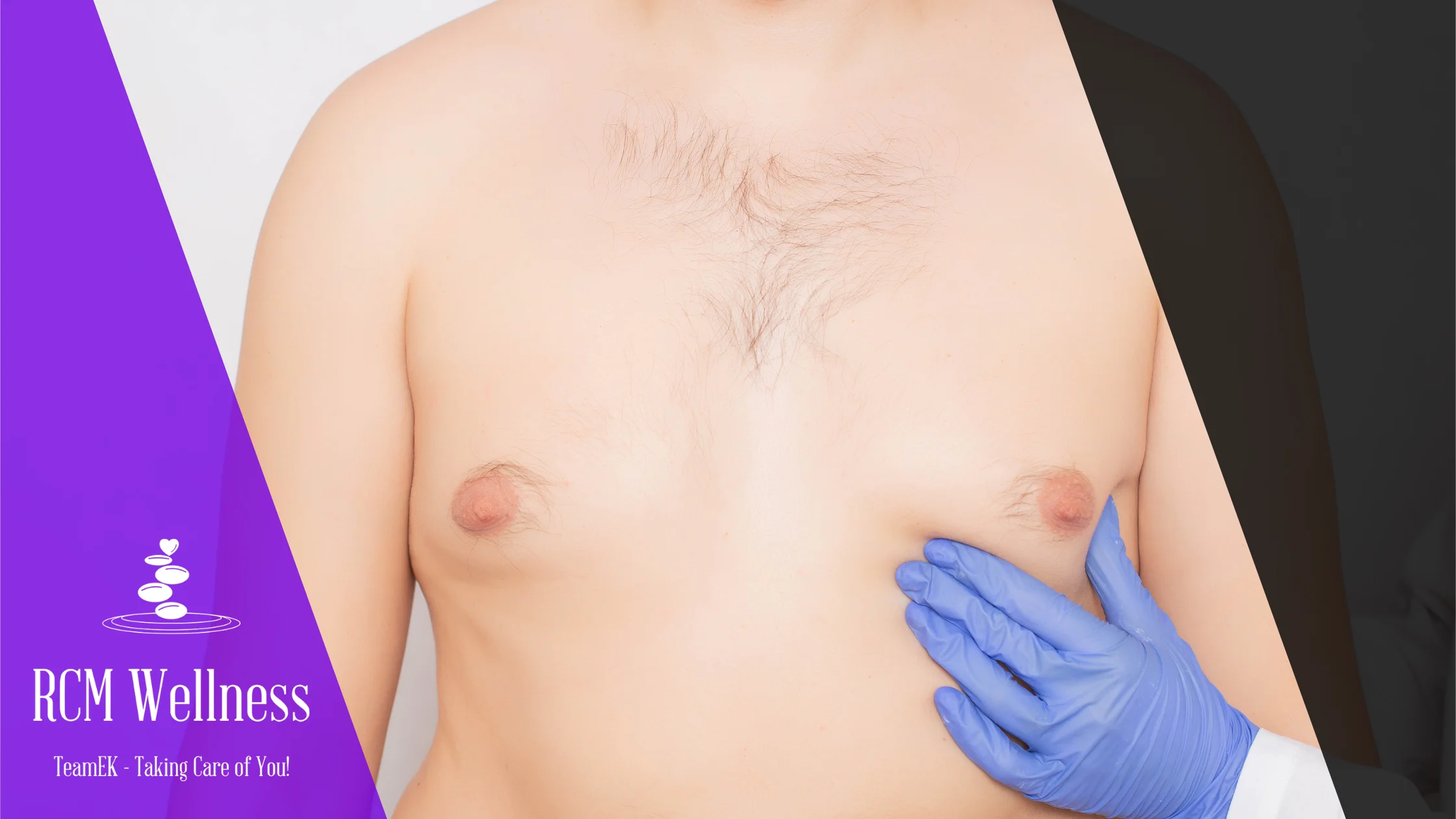 Pectoral Fat Reduction & Skin Tightening