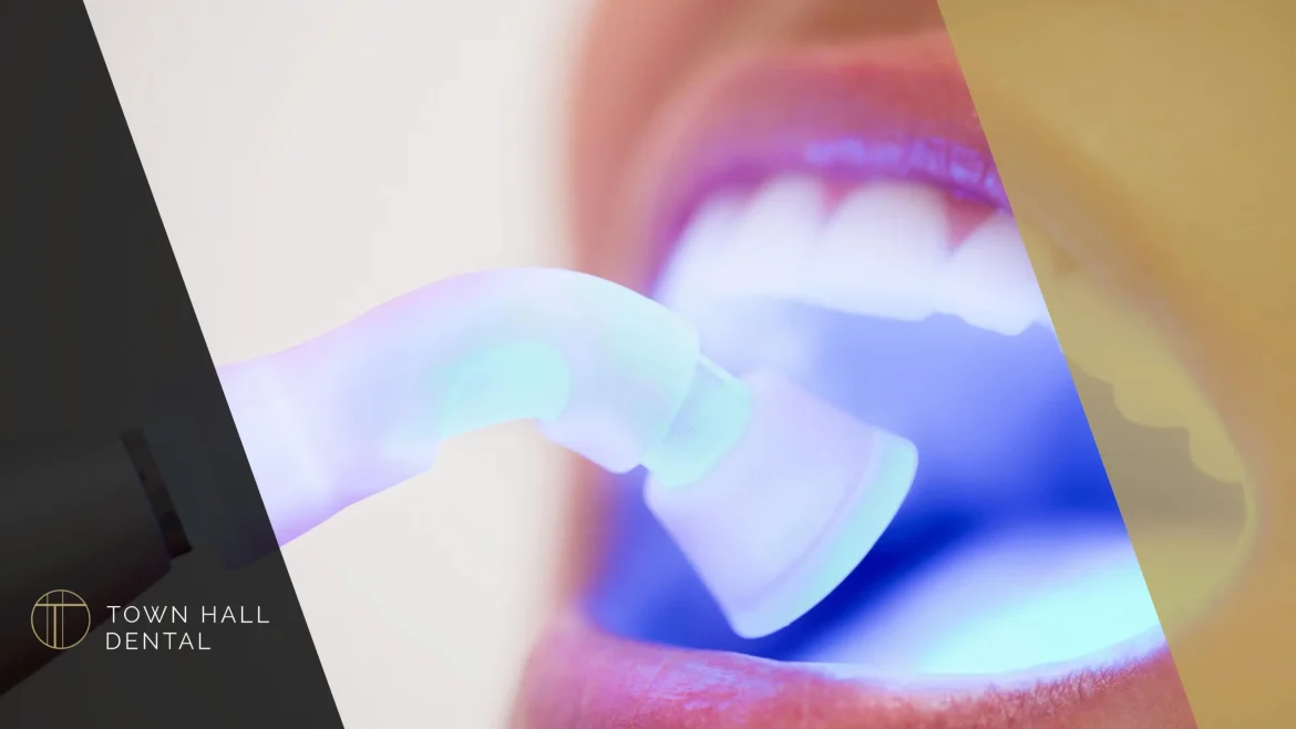 Teeth Whitening