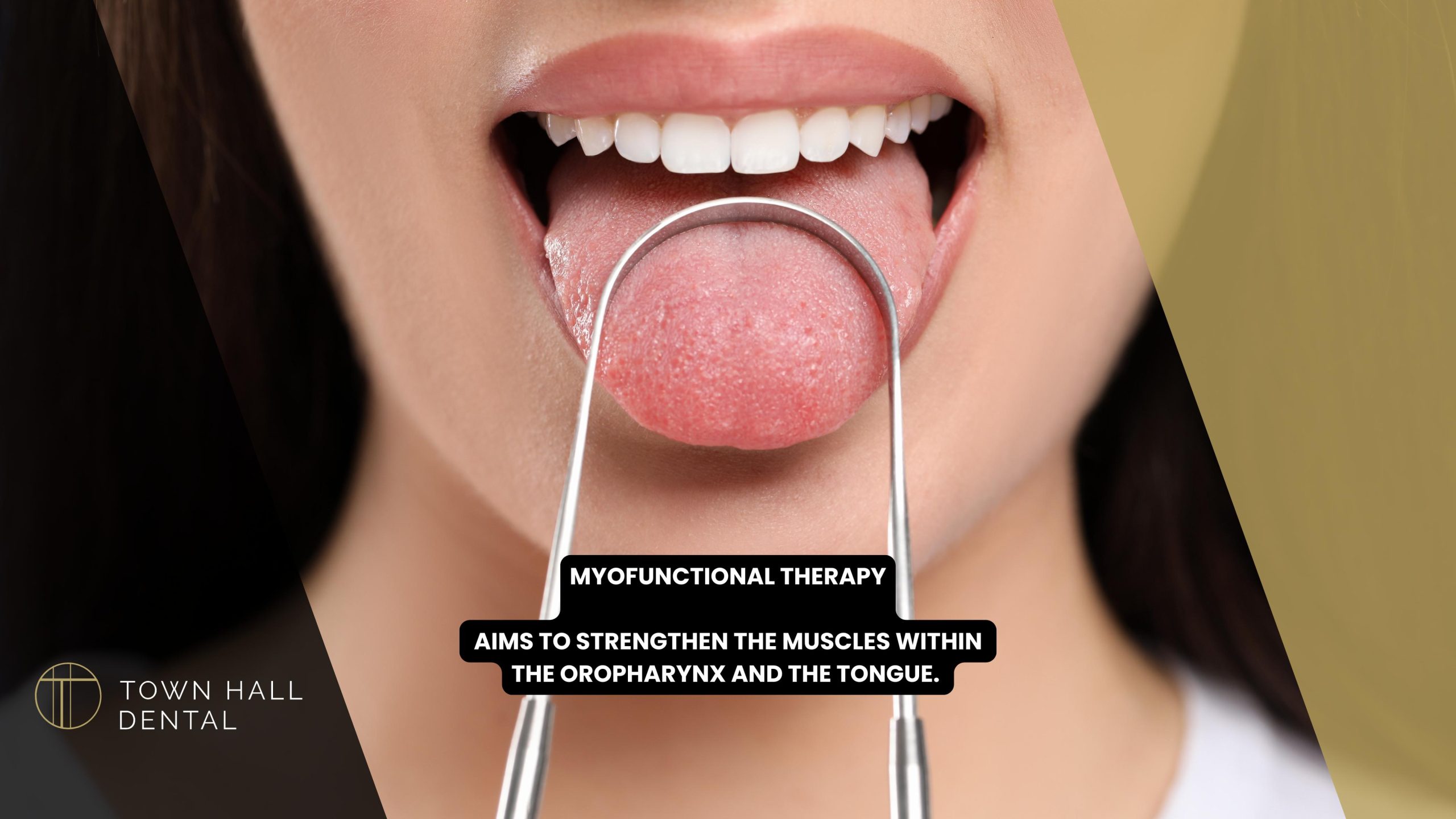 Myofunctional Therapy