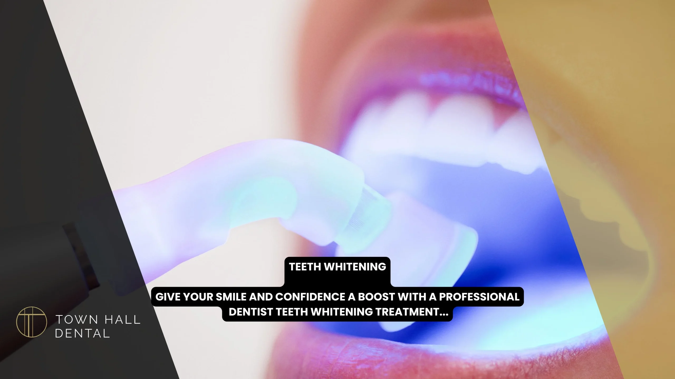 Teeth Whitening